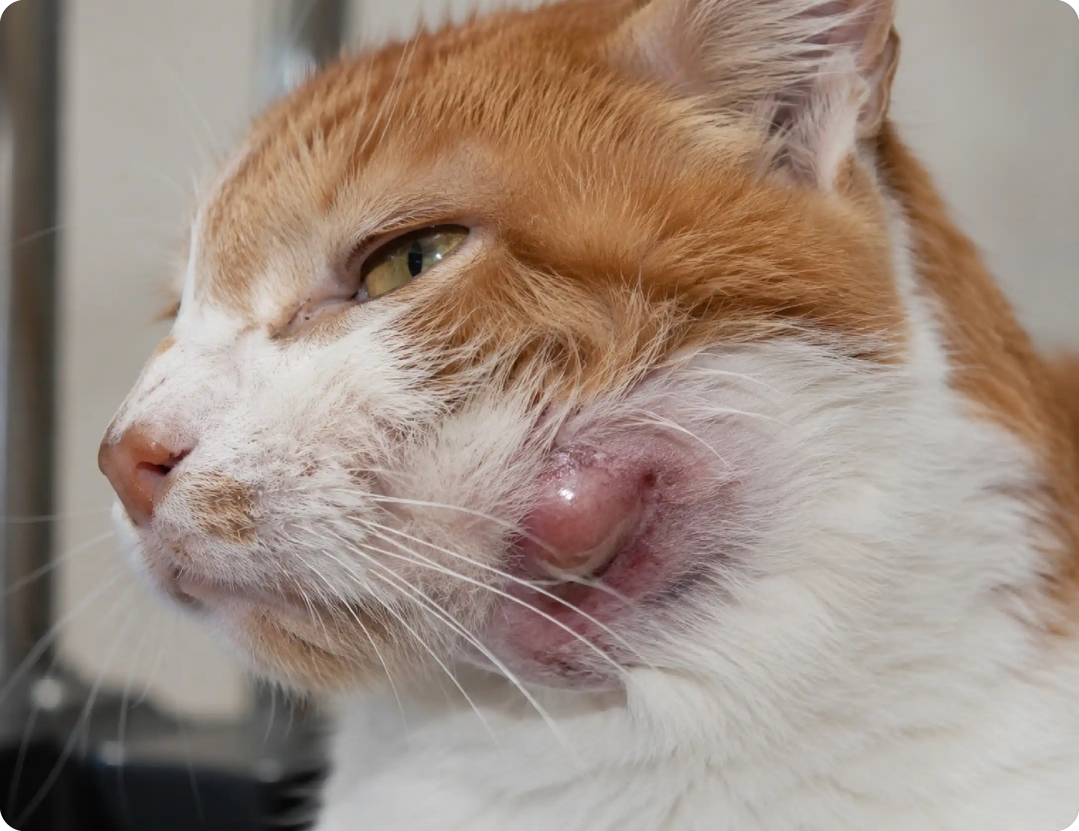 Dental Abscesses